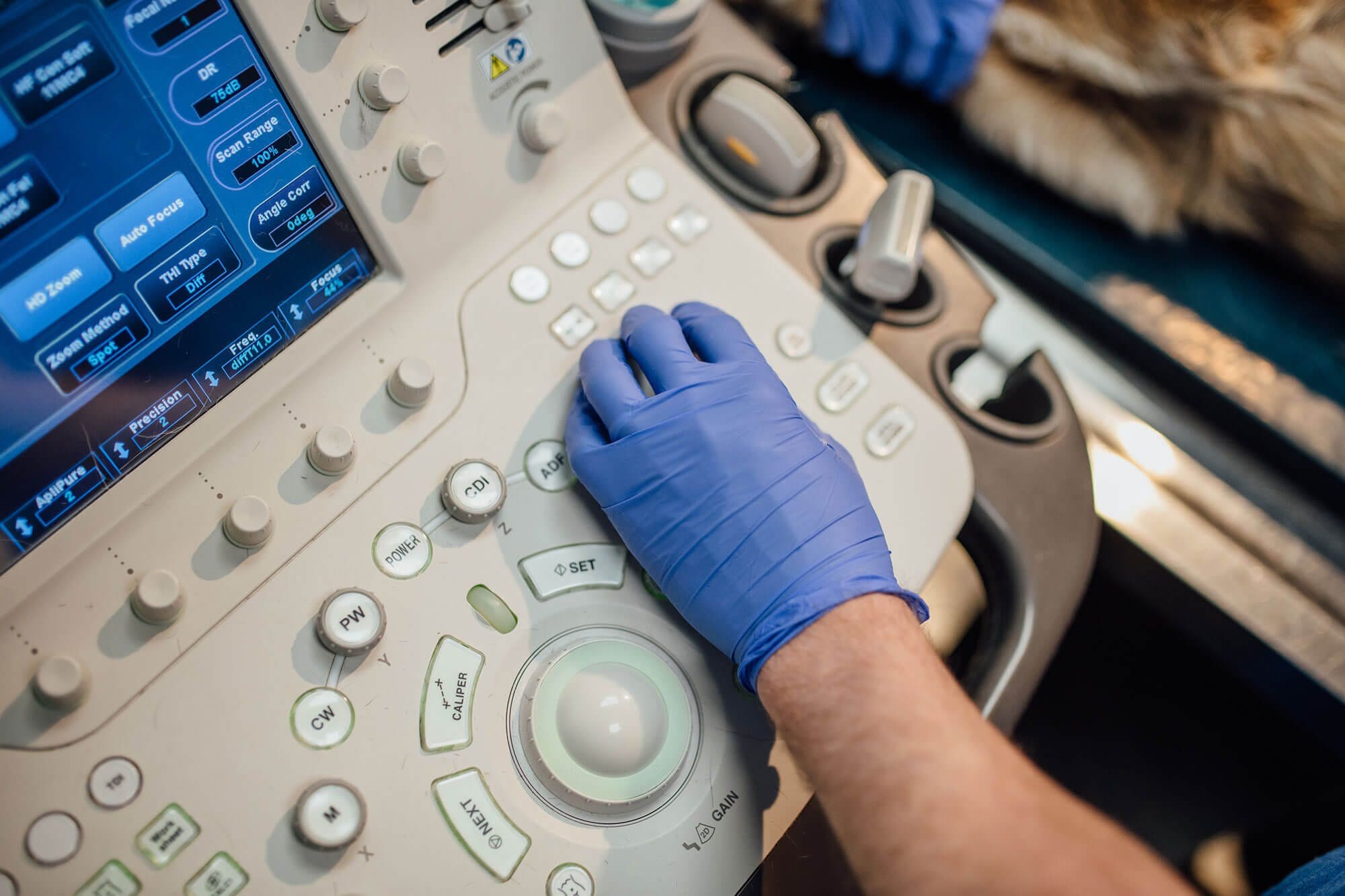 ultrasound machine